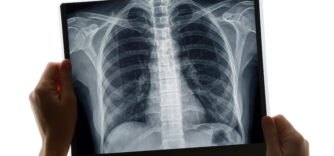 Mon physio peut-il me prescrire une radiographie?
