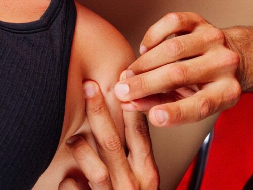 Acupuncture