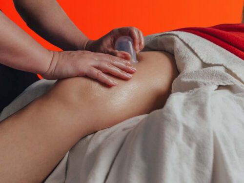 Cupping Therapy