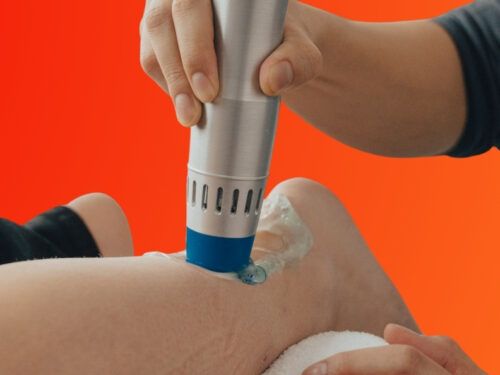 Shockwave Therapy