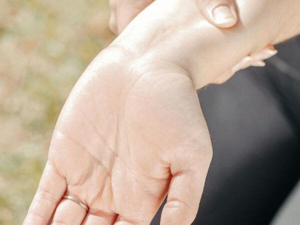 Carpal Tunnel Syndrom