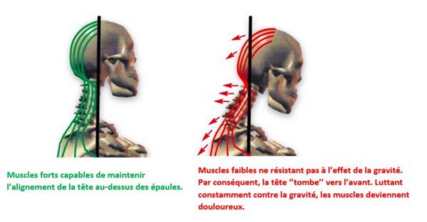 5 conseils pour prévenir les douleurs au cou et aux omoplates pendant le travail de bureau et les trapèzes chez Kinatex Sports Physio, Québec et Ontario.