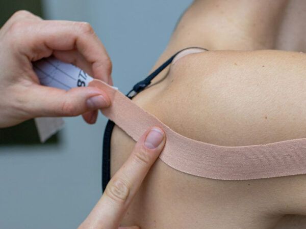 Adhesive Capsulitis of the Shoulder