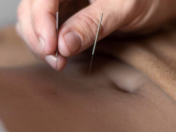Comment se déroule une première rencontre en acupuncture ?
