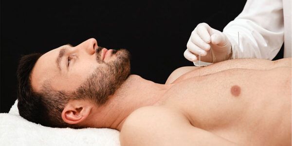 Stimuler naturellement la fertilité par l'acupuncture chez les hommes chez Kinatex Sports Physio, Québec et Ontario.