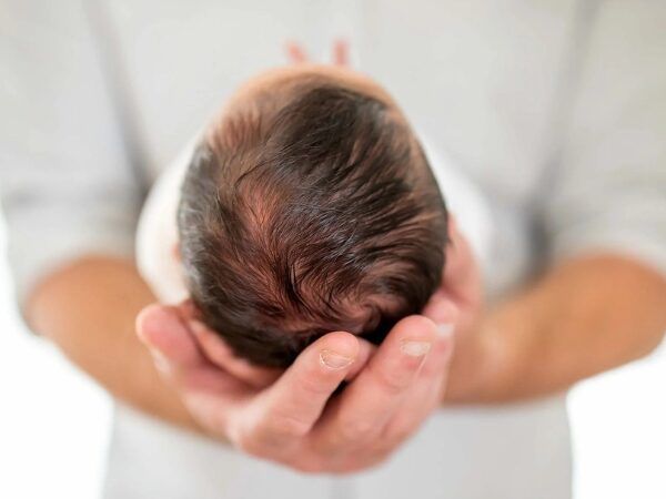 Syndrome de la tête plate (plagiocéphalie) chez le bébé : comment le prévenir et le traiter ?